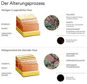 ELLANSÉ® Alterungsprozess