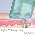 GlySal-Säure-Peeling
