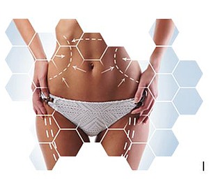 CelsiaShape-Problemzonen