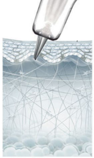 Behandlungsablauf BeautyfEYE Step 2