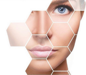 THESERA L - Lifting durch Seidenfäden