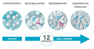 Wirkweise von Radiesse