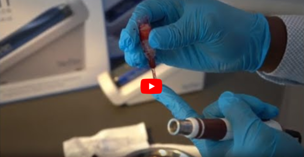 Video »NoName«-Microneedling-Pen