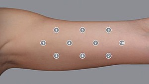 ALT-Tag: ProfHilo®-BAP-Technik