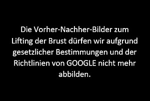 Ersatz Vorher-Nachher-Foto