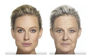 Morpheus8 Hautalterung