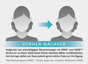 Ersatz für Vorher-Nachhher-Fotos