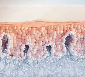 Wirkweise von HArmonyCa