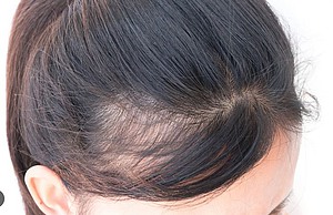 Wirkweise von PolyPhil Hair