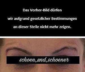 Ersatz Vorher-Nachher-Foto