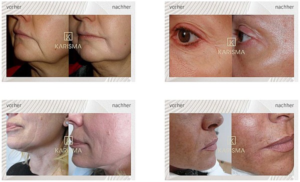 Ergebnisse mit Karisma