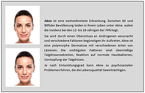 Hautproblem Akne