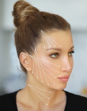 Faden-Lifting Gesicht