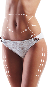 Körperareale für CelsiaShape-Behandlung