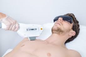 IPL Dauerhafte Haarentfernung