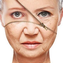 Wirkung von SCULPTRA