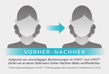 Ersatz Vorher-Nachher-Fotos